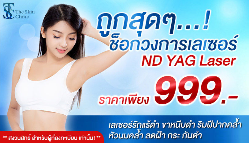 โปรโมชั่นพิเศษ ND YAG LASER ราคาถูกมาก